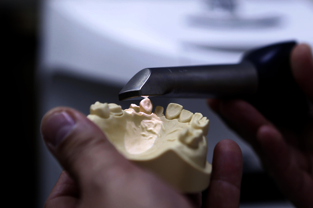 El Hospital Odontológico Universitario realiza implantes en menos de una hora 