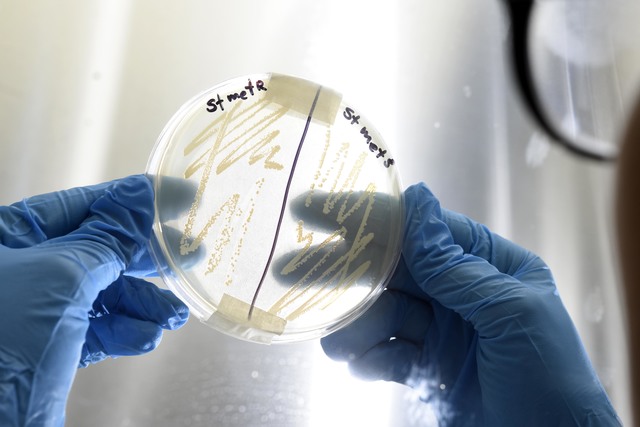 Con la Nanotecnología como aliada, científicos de la UNLP luchan contra infecciones bacterianas graves Con la Nanotecnología como aliada, científicos de la UNLP luchan contra infecciones bacterianas graves