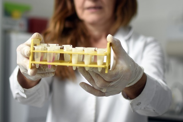 La UNLP ya realizó más de 20 mil testeos de diagnóstico para la detección de casos de coronavirus La UNLP ya realizó más de 20 mil testeos de diagnóstico para la detección de casos de coronavirus