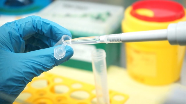 La UNLP ya realizó más de 20 mil testeos de diagnóstico para la detección de casos de coronavirus La UNLP ya realizó más de 20 mil testeos de diagnóstico para la detección de casos de coronavirus
