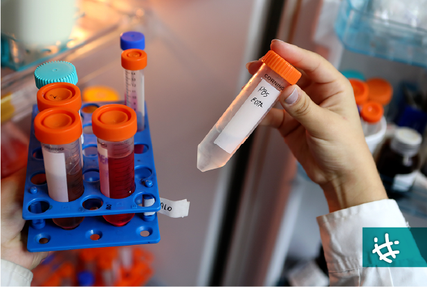 Síndrome metabólico y metformina: impacto simultáneo en huesos y arterias